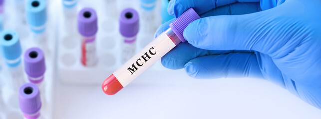 Obraz premium Doctor holding blood sample tube with MCHC test, mean corpuscular hemoglobin concentration analysis for anemia diagnosis, red blood cell quality evaluation and hemoglobin saturation assessment