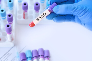 Naklejka premium Doctor holding blood sample tube with BASO test in medical laboratory, basophil blood analysis for allergy, inflammation and immune system diagnostics, healthcare concept, copy space