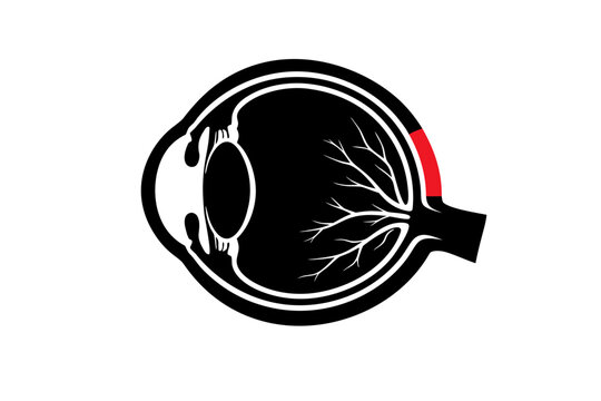 Scleritis Anatomical Cross Section Silhouette Vector Diagram