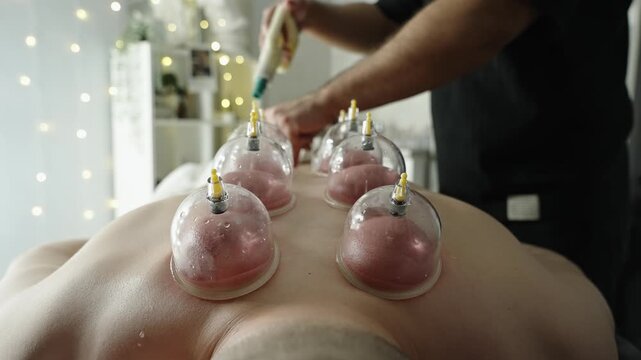 Close-up of cupping therapy on a client's back, with multiple transparent suction cups creating vacuum for muscle relief in a tranquil spa setting as a therapist prepares treatment