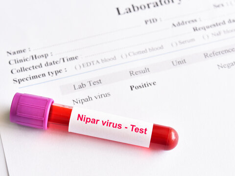 Positive result of Nipah virus test with blood sample tube