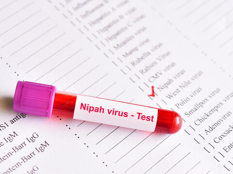 Blood sample tube for Nipah virus test