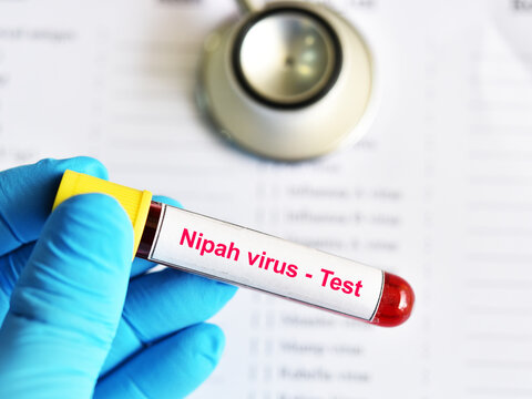 Blood sample tube for Nipah virus test