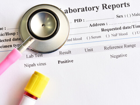 Positive result of Nipah virus test with blood sample tube