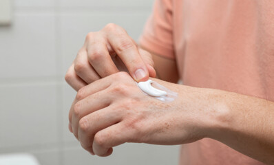 Close up of male hands applying white medicinal or cosmetic cream onto skin to treat dryness or irritation in a bathroom setting