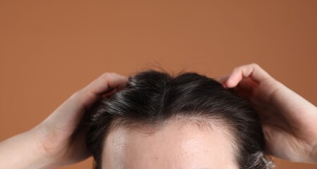 Fototapeta premium Woman with hair loss problem on brown background, closeup