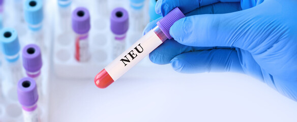 Naklejka premium Neu blood test for neutrophil count assessment with doctor holding laboratory sample tube during clinical diagnostics and hematology analysis in modern medical laboratory with copy space