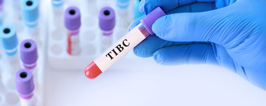 Doctor holding TIBC blood test tube explaining total iron binding capacity for iron deficiency assessment and anemia diagnosis in clinical laboratory medicine concept