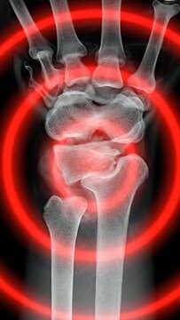 Dynamic Wrist Xray Focus With Red Circle Highlight.