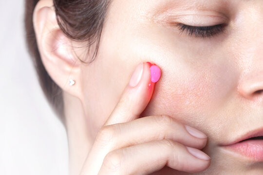 A drop of capsule pink cream on the finger of a woman. Caucasian woman applies cream to her face. Swatch of pink popular Niacinamide Capsule Cream. isolated on pink background photo