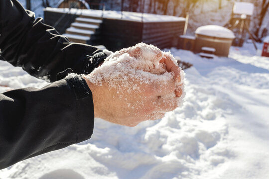 Frozen male hands covered in snow. Male hands with dry skin in the cold. Hand care in winter. Risk of frostbite of hand because of frost in winter