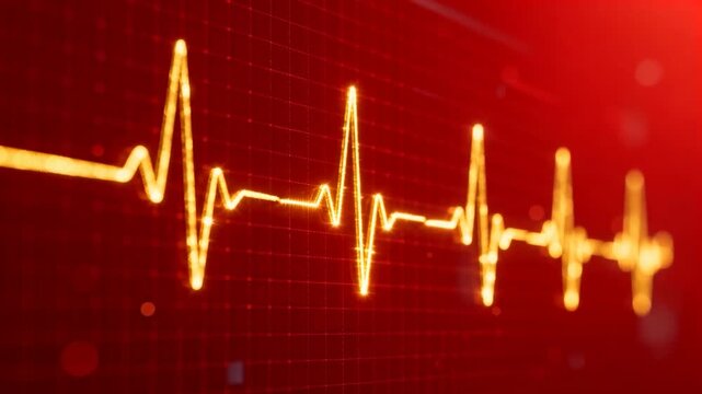 Playback starting, gold ECG trace pulsing and sweeping across red grid, showing cardiac rhythm