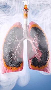 Damaged lungs with dark patches from smoking, connected to a lit cigarette emitting smoke