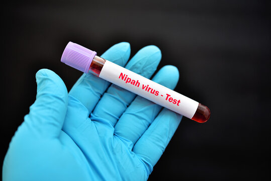 Blood sample tube for Nipah virus test