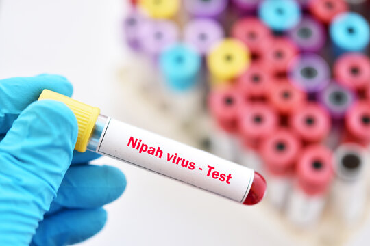 Blood sample tube for Nipah virus test