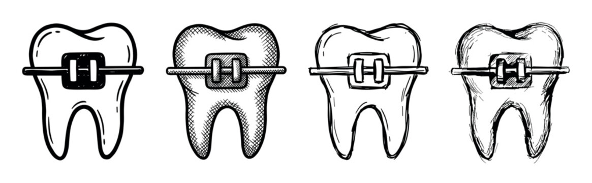 Four hand-drawn molar teeth with metal braces and archwires, a collection of black and white sketch illustrations for orthodontic treatment and dental health concepts
