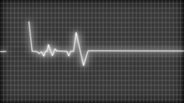 Digital heartbeat monitor showing a flatline with a brief spike animation