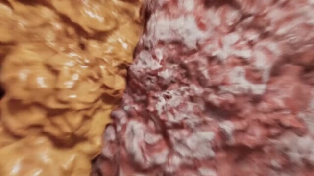 Detailed Medical Illustration of Atherosclerosis Featuring a Blocked Human Artery with Restricted Blood Flow and Cholesterol Plaque Accumulation within the Vascular System Cardiovascular Disease