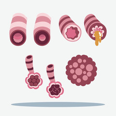 Medical illustration showing the comparison between healthy and diseased bronchioles and alveoli in the human respiratory system.