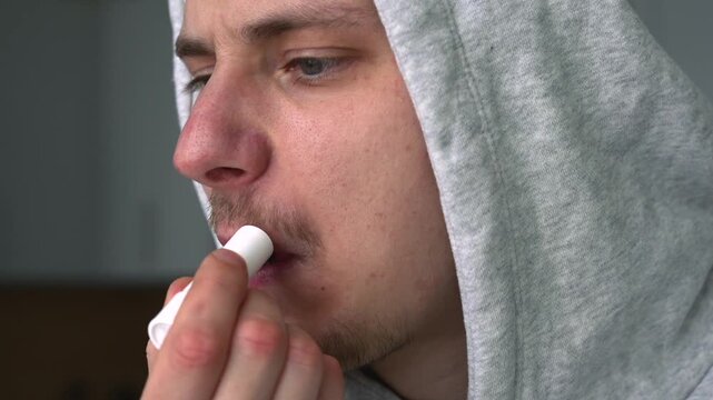 Cold sores on the lips.
Using chapstick to moisturize lips