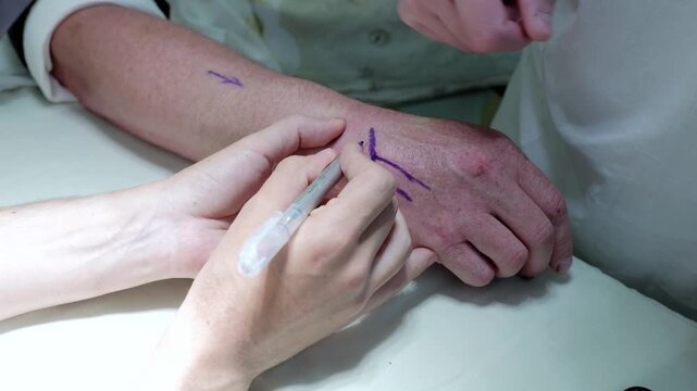 Russia Tomsk 05.07.2025: Medical staff outline incision sites, Healthcare specialists carefully draw surgical incision lines in preparation, Surgical team meticulously plans and marks