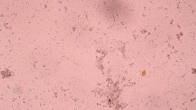 View in microscopic Strongyloides stercoralis or threadworm in human stool.Parasite or fluke infection.Medical background analyze by microscope, original magnification 400x