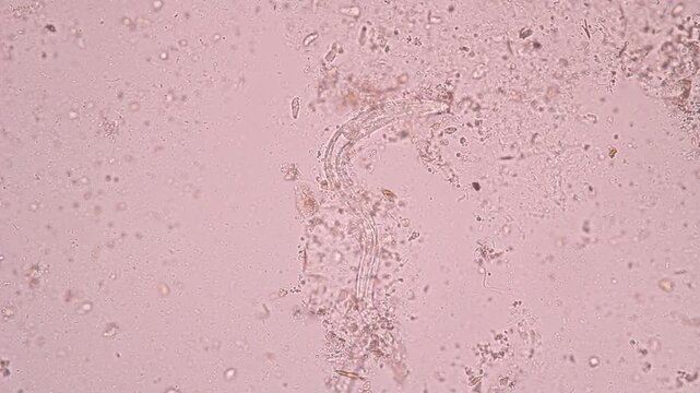 View in microscopic Strongyloides stercoralis or threadworm in human stool.Parasite or fluke infection.Medical background analyze by microscope, original magnification 400x