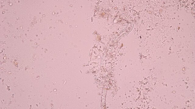 View in microscopic Strongyloides stercoralis or threadworm in human stool.Parasite or fluke infection.Medical background analyze by microscope, original magnification 400x