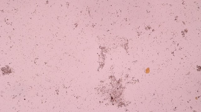 View in microscopic Strongyloides stercoralis or threadworm in human stool.Parasite or fluke infection.Medical background analyze by microscope, original magnification 400x