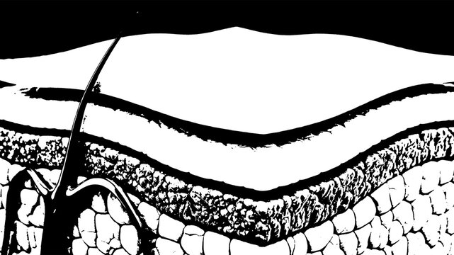 Cross-section of healthy human skin layers with a hypodermic needle injecting medicine, science and medical illustration in black and white.