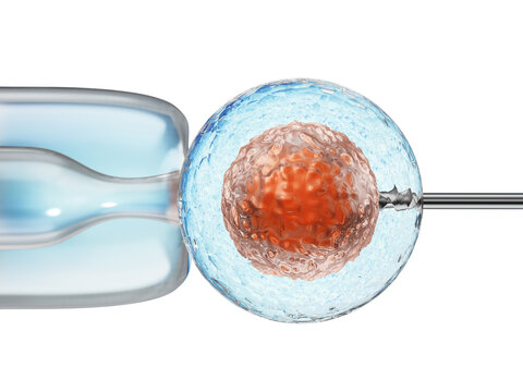 Artificial insemination process showings sperms being injected inside the ovule on transparent background. 3D illustration