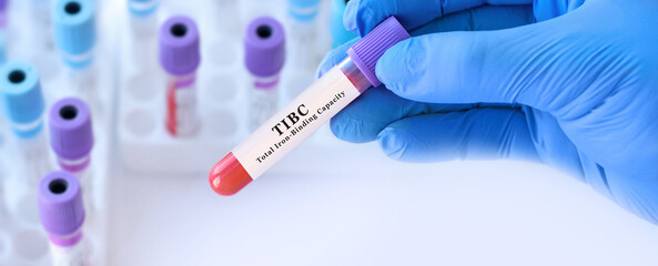 Obraz premium Doctor holding TIBC blood test tube explaining total iron binding capacity for iron deficiency assessment and anemia diagnosis in clinical laboratory medicine concept