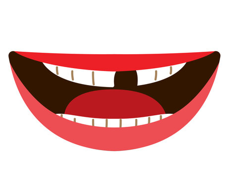 Cartoon vector illustration of a close-up mouth with missing teeth isolated on white background. Clip art for dental care, oral health education, dentistry and medical awareness