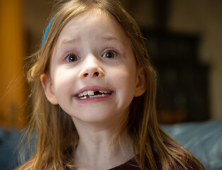 Zahnl&uuml;ckenportrait