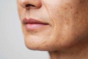 Close up of human skin with visible pores and sun spots texture aging