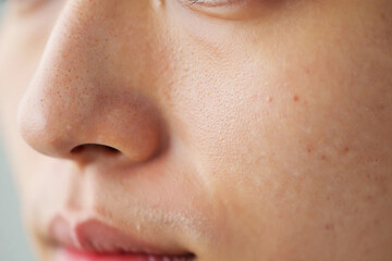 Fototapeta premium Extreme close up of human skin texture with visible pores and blemishes close-up