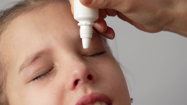 Close-up of Girl Receiving Eye Drops for Redness. Close-up of a young girl with her eyes closed, receiving medicinal drops from a white bottle. Perfect for healthcare, allergy, ophthalmology concepts