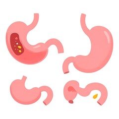 Four pink stomach illustrations with different internal views
