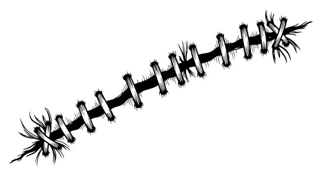 Distressing hand drawn medical scar with thick stitches in dark horror style