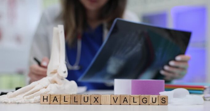 Wooden cubes spell term Hallux Valgus near foot skeleton model. Orthopedic doctor checks patient X-ray planning correction for bunion deformity