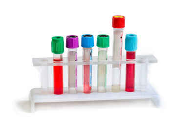 Several Test Tubes Are Arranged in a Holder