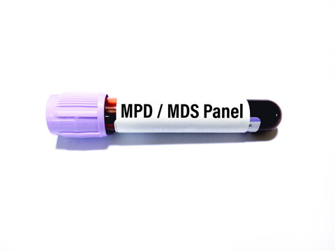 Blood sample for Myeloproliferative Disorders (MPD) and Myelodysplastic Syndromes (MDS) test. Medical testing concept with white background.