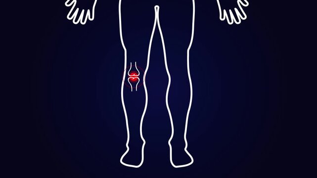 2D animation showing a human lower body with a red-highlighted right knee area, suggesting pain or injury. Ideal for medical, health, or wellness topics.
