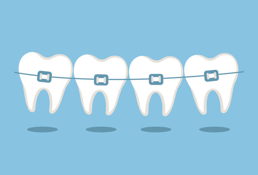 Teeth with braces on blue background. Dental braces, bracket, orthodontic, dentistry symbol. Dental care concept. Straightening of crooked bites. Vector illustration in flat style