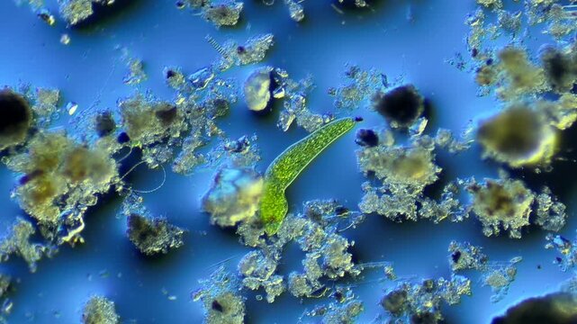 Euglenids and other microorganisms under the microscope at 100x Magnification