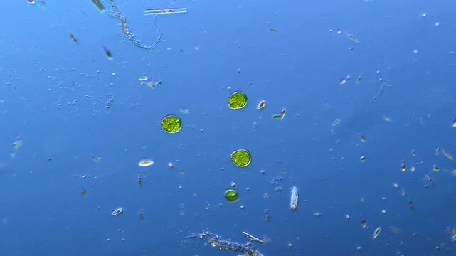 Euglenids and other microorganisms under the microscope at 100x Magnification