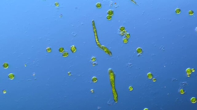 Euglenids and other microorganisms under the microscope at 100x Magnification