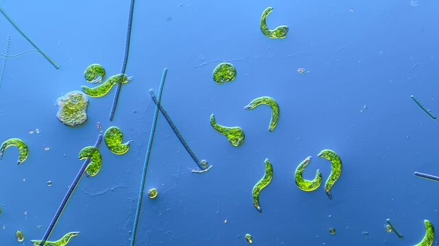 Euglena and other microorganisms under the microscope at 100x Magnification