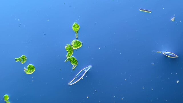 Euglena and other microorganisms under the microscope at 100x Magnification
