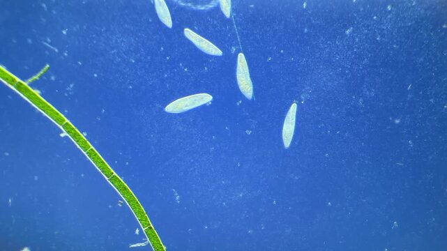 Numerous microorganisms under the microscope